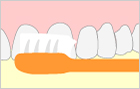 ブラッシング指導